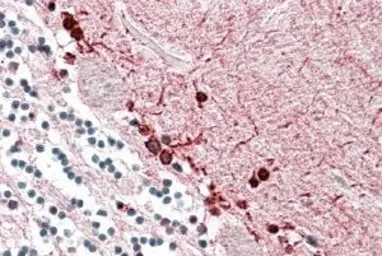 Anti-ALDH9A1 antibody, Internal used in IHC (Paraffin sections) (IHC-P). GTX88101