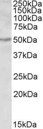 Anti-ALDH9A1 antibody, Internal used in Western Blot (WB). GTX88101