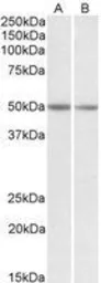 Anti-GNAS antibody, Internal used in Western Blot (WB). GTX88107