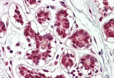 Anti-Cullin 2 antibody, C-term used in IHC (Paraffin sections) (IHC-P). GTX88108