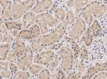 Anti-NIPBL antibody, Internal used in IHC (Paraffin sections) (IHC-P). GTX88110