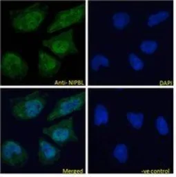 Anti-NIPBL antibody, Internal used in Immunocytochemistry/ Immunofluorescence (ICC/IF). GTX88110