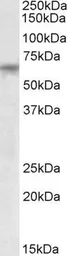Anti-TTC8 antibody, Internal used in Western Blot (WB). GTX88117