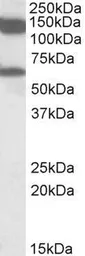 Anti-AF10 antibody, Internal used in Western Blot (WB). GTX88120