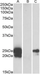 Anti-HE4 antibody, Internal used in Western Blot (WB). GTX88122