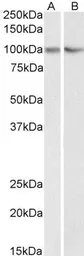 Anti-TRIM71 (aa390-402) antibody, Internal used in Western Blot (WB). GTX88128