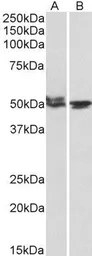 Anti-MON1A (aa478-489) antibody, Internal used in Western Blot (WB). GTX88138