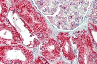 Anti-CHCHD3 (aa151-164) antibody, Internal used in IHC (Paraffin sections) (IHC-P). GTX88140