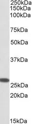 Anti-CHCHD3 (aa151-164) antibody, Internal used in Western Blot (WB). GTX88140