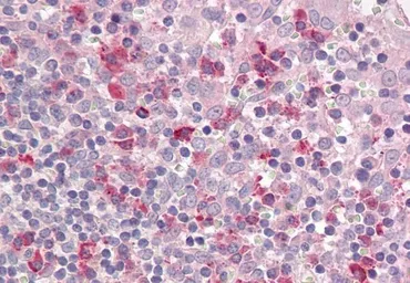 Anti-LAIR1 antibody, Internal used in IHC (Paraffin sections) (IHC-P). GTX88141