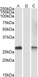 Anti-DYDC1 (aa142-154) antibody, Internal used in Western Blot (WB). GTX88143