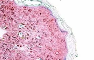 Anti-TRIM29 antibody, Internal used in IHC (Paraffin sections) (IHC-P). GTX88145