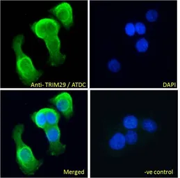 Anti-TRIM29 antibody, Internal used in Immunocytochemistry/ Immunofluorescence (ICC/IF). GTX88145