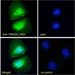 Anti-TRIM29 antibody, Internal used in Immunocytochemistry/ Immunofluorescence (ICC/IF). GTX88145