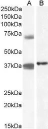 Anti-TRIM29 antibody, Internal used in Western Blot (WB). GTX88145