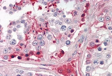 Anti-CRISP2 antibody, Internal used in IHC (Paraffin sections) (IHC-P). GTX88148