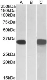 Anti-CRISP2 antibody, Internal used in Western Blot (WB). GTX88148