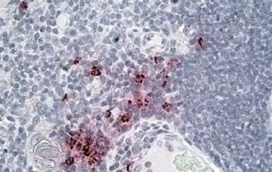 Anti-DEFA1/3 precursor antibody, Internal used in IHC (Paraffin sections) (IHC-P). GTX88155