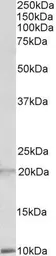 Anti-DEFA1/3 precursor antibody, Internal used in Western Blot (WB). GTX88155