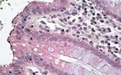 Anti-SLC12A2 antibody, Internal used in IHC (Paraffin sections) (IHC-P). GTX88157