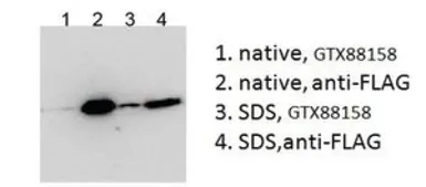 Anti-BICC1 (aa223-234) antibody, Internal used in Immunoprecipitation (IP). GTX88158