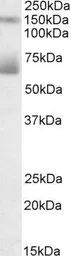 Anti-Mesothelin antibody, Internal used in Western Blot (WB). GTX88160