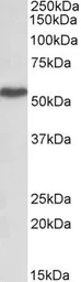 Anti-LSP1 (aa261-275) antibody, Internal used in Western Blot (WB). GTX88162