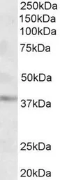 Anti-GHITM (aa117-127) antibody, Internal used in Western Blot (WB). GTX88163