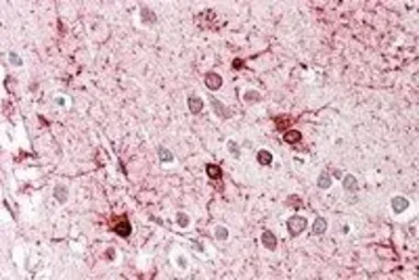 Anti-GLUD1 + GLUD2 antibody, Internal used in IHC (Paraffin sections) (IHC-P). GTX88164