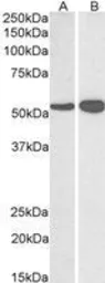 Anti-GLUD1 + GLUD2 antibody, Internal used in Western Blot (WB). GTX88164