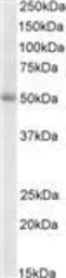 Anti-TRIP6 antibody, Internal used in Western Blot (WB). GTX88170
