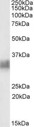 Anti-CD317 antibody, Internal used in Western Blot (WB). GTX88171