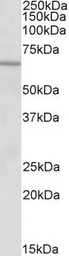 Anti-ACADVL antibody, N-term used in Western Blot (WB). GTX88173