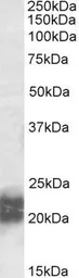 Anti-NPC2 antibody, Internal used in Western Blot (WB). GTX88174