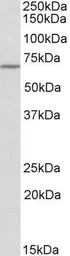 Anti-THEMIS antibody, C-term used in Western Blot (WB). GTX88179