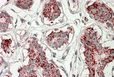 Anti-Aconitase 2 antibody, Internal used in IHC (Paraffin sections) (IHC-P). GTX88183