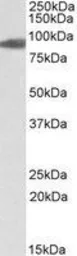Anti-Aconitase 2 antibody, Internal used in Western Blot (WB). GTX88183