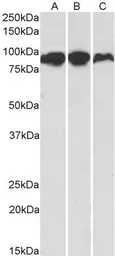 Anti-Aconitase 2 antibody, Internal used in Western Blot (WB). GTX88183