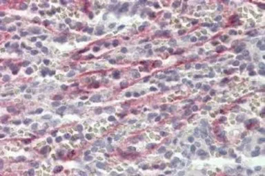 Anti-Stabilin 1 antibody, C-term used in IHC (Paraffin sections) (IHC-P). GTX88184