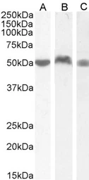 Anti-LSP1 antibody, C-term used in Western Blot (WB). GTX88185