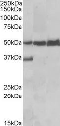 Anti-LSP1 antibody, C-term used in Western Blot (WB). GTX88185