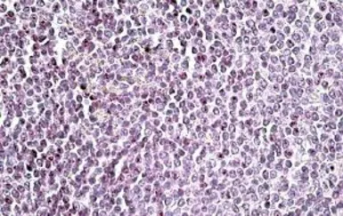 Anti-AIM2 antibody, C-term used in IHC (Paraffin sections) (IHC-P). GTX88186