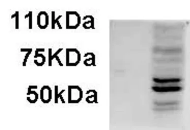 Anti-AIM2 antibody, C-term used in Western Blot (WB). GTX88186