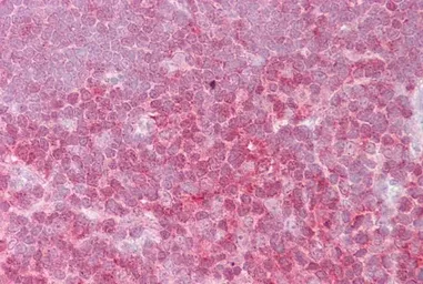 Anti-c-Rel antibody, Internal used in IHC (Paraffin sections) (IHC-P). GTX88187