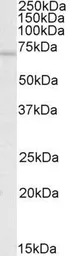 Anti-c-Rel antibody, Internal used in Western Blot (WB). GTX88187