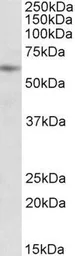 Anti-PIAS2 (aa185-196) antibody, Internal used in Western Blot (WB). GTX88188