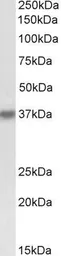 Anti-HSH2D antibody, Internal used in Western Blot (WB). GTX88192
