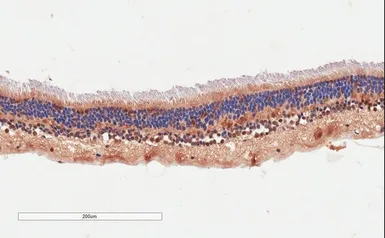 Anti-ARMS2 antibody, Internal used in IHC (Paraffin sections) (IHC-P). GTX88195