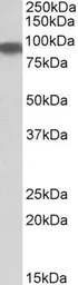 Anti-Aconitase 2 antibody, Internal used in Western Blot (WB). GTX88196