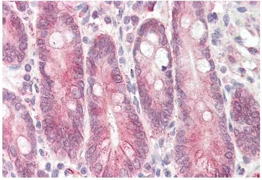 Anti-STAP2 (aa391-403) antibody, C-term used in IHC (Paraffin sections) (IHC-P). GTX88199